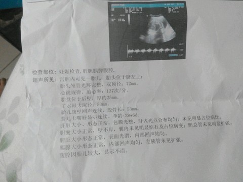 journal_insert_pic_266035200