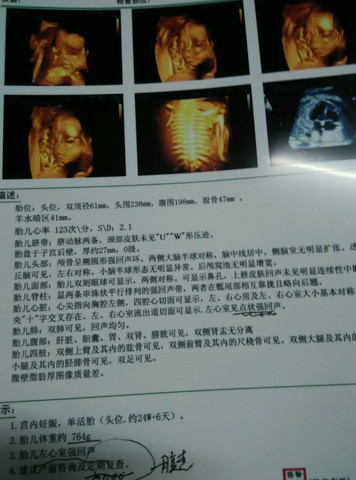journal_insert_pic_271704566