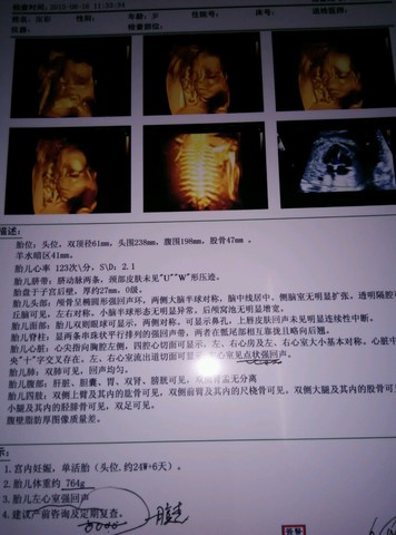 journal_insert_pic_271704448