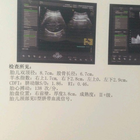 journal_insert_pic_273216611