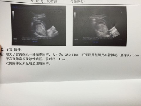 journal_insert_pic_274054832