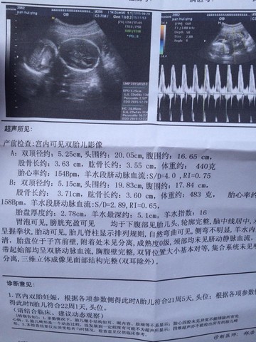 journal_insert_pic_273954179
