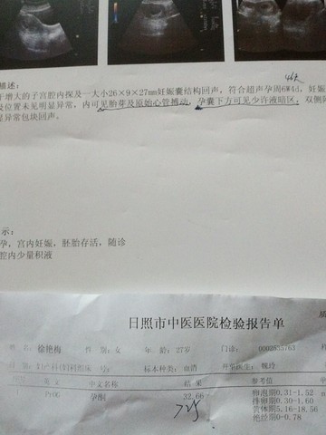journal_insert_pic_278704962