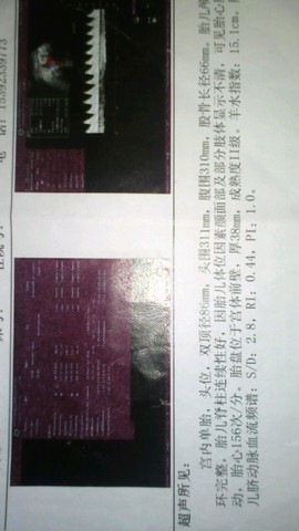 journal_insert_pic_279552887