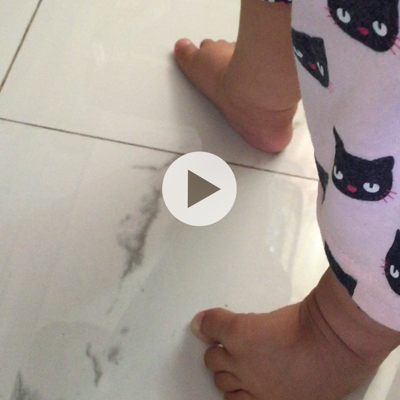 宝宝九个月 脚站起来就这样 脚掌总是站不平 怕不怕有什麼问题