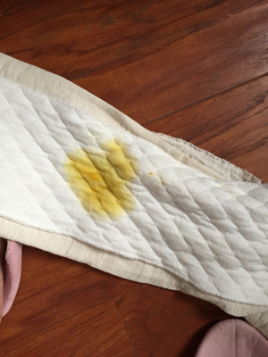 宝宝15天了,放屁总是带出黄色的水粑粑,就像图片上的那种,母乳餵养