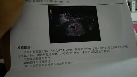 journal_insert_pic_306341022