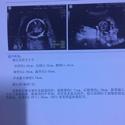 journal_insert_pic_315572168