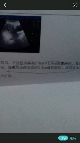 journal_insert_pic_315623360