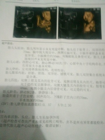 journal_insert_pic_315596297