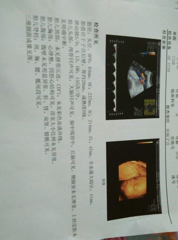 journal_insert_pic_315339462