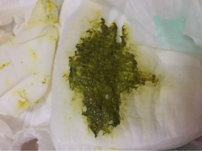 大便是绿色的 宝宝树