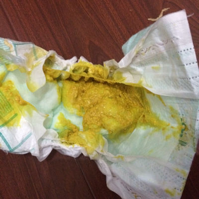 宝宝这样的大便正常吗,第一次拉这么多,拉的时候还像放屁似的