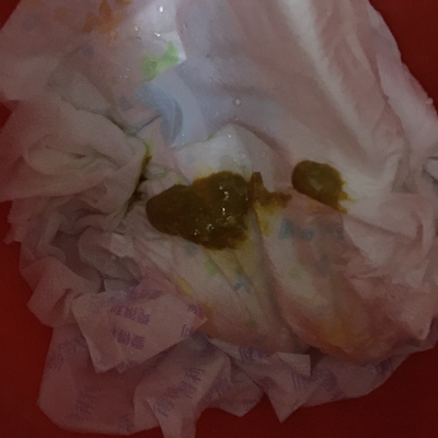 宝宝用热水洗洗屁股拉的粑粑很粘稠,肚子有点涨,有时候隔好几天也不拉