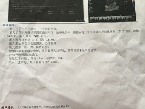 journal_insert_pic_326164874