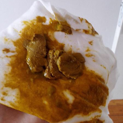 七个多月宝宝拉这种便便正常吗