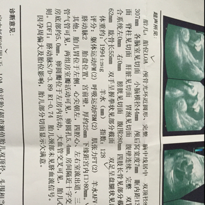 我孕34周了!前几天做彩超显示宝宝头大,身子小;害.