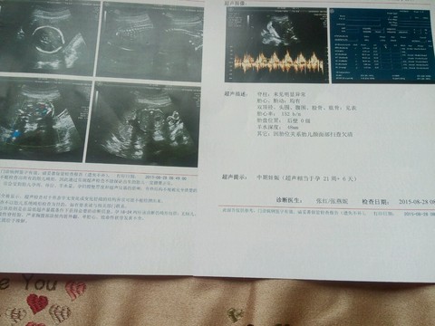 journal_insert_pic_347999104