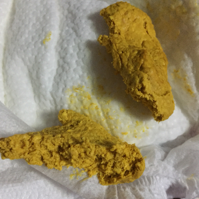 医生们,妈妈们,帮我看看宝宝大便正常吗?