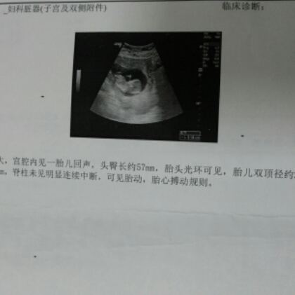 journal_insert_pic_356306200