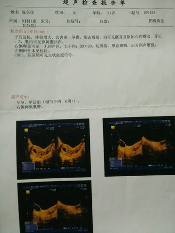 journal_insert_pic_358295418