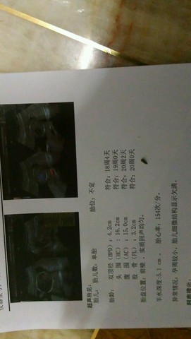 journal_insert_pic_361165250