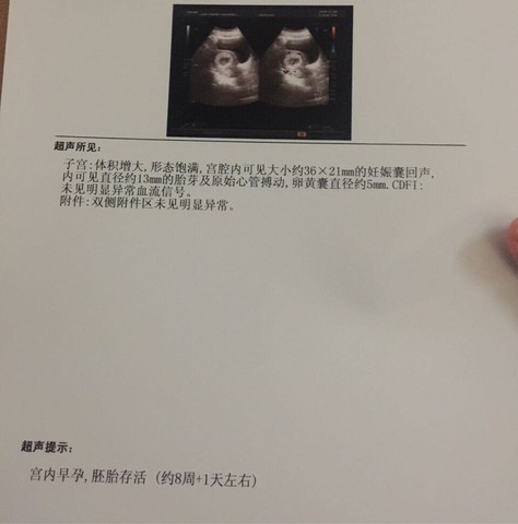 journal_insert_pic_369265512
