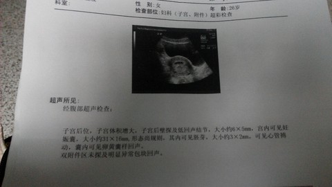 journal_insert_pic_371526364