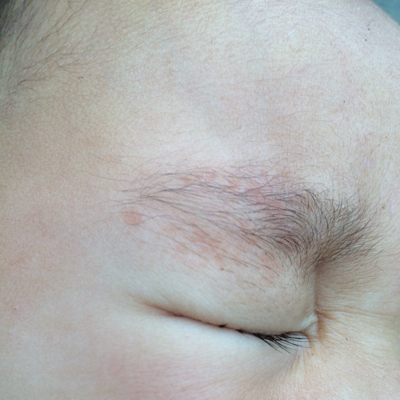 婴儿眉毛中间凹陷图片图片