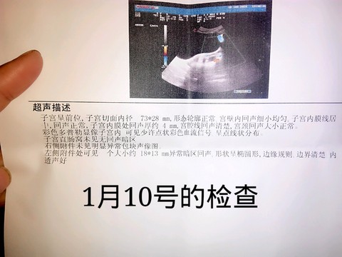 journal_insert_pic_384770780