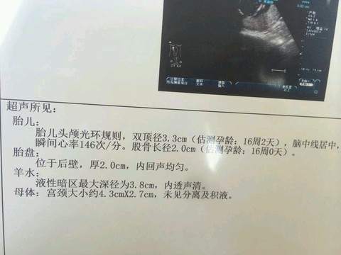journal_insert_pic_386189345