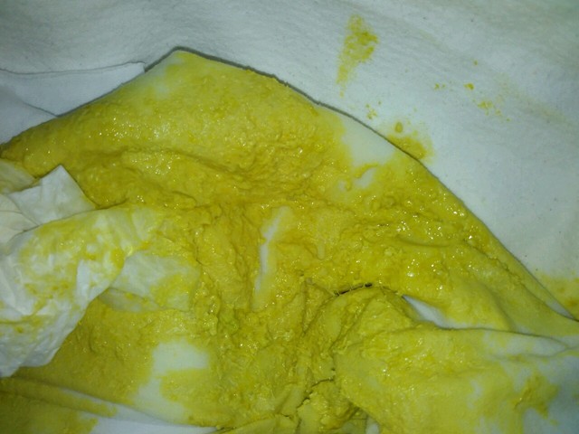 50天母乳宝宝大便臭,比较稀,一天四五次,是什么问题