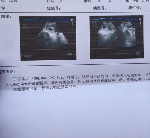 journal_insert_pic_389176421