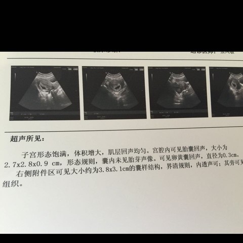 journal_insert_pic_389715556