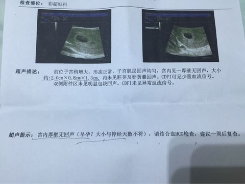journal_insert_pic_391018098