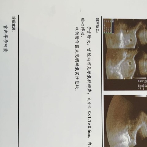 journal_insert_pic_390835475