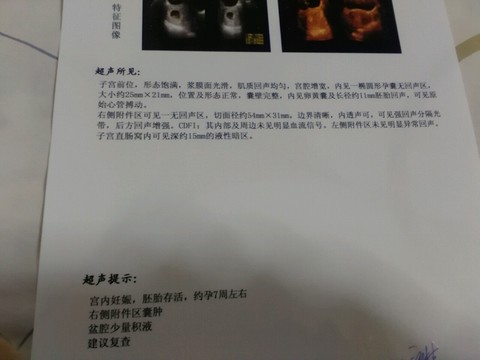 journal_insert_pic_392352227