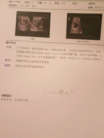 journal_insert_pic_392325801