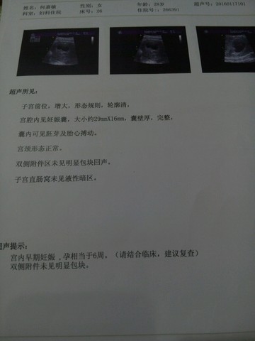 journal_insert_pic_394150093