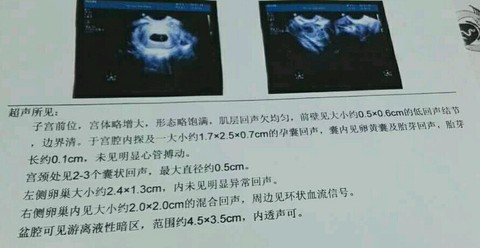 journal_insert_pic_394911355