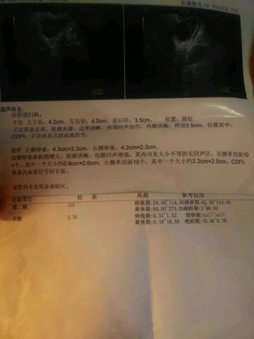 journal_insert_pic_395456702