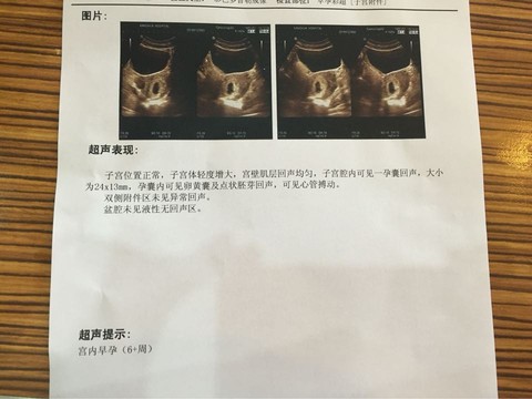 journal_insert_pic_395767406