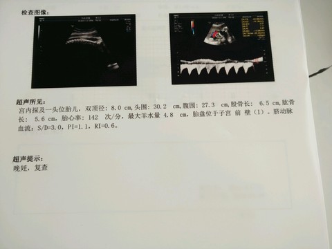 journal_insert_pic_396844621