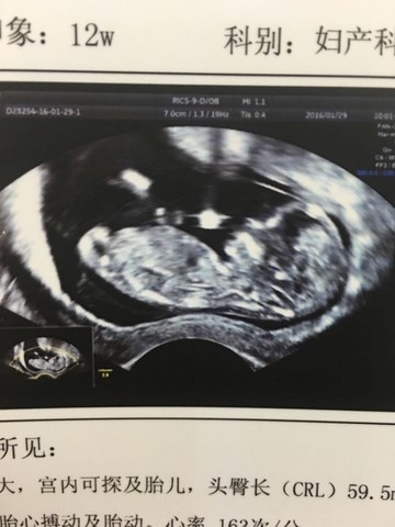 journal_insert_pic_397015777