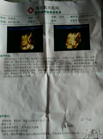 journal_insert_pic_397325843