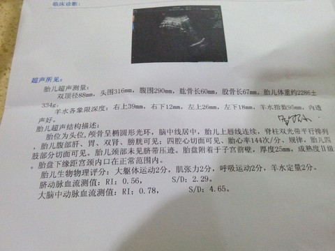 journal_insert_pic_398601878