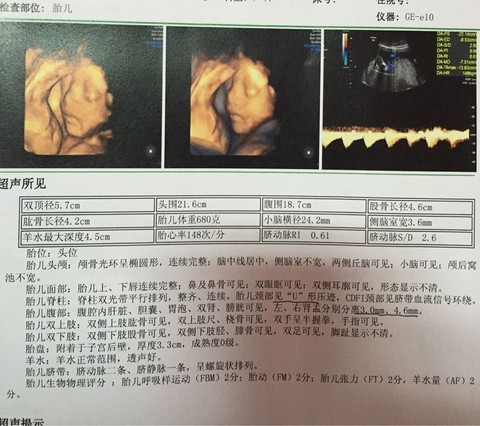 journal_insert_pic_400645033