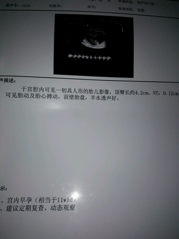 journal_insert_pic_401126452