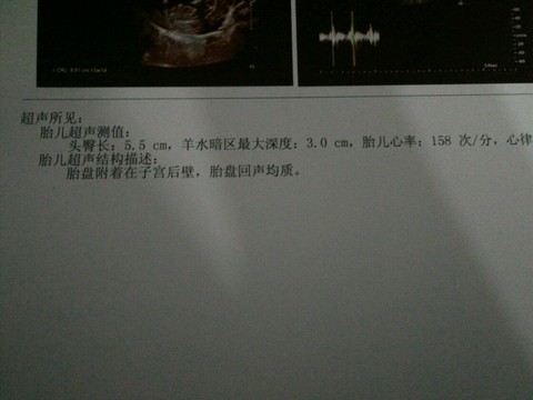 journal_insert_pic_407758246