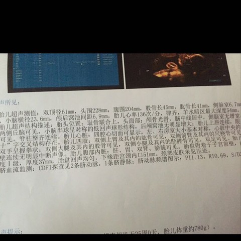 journal_insert_pic_410154361